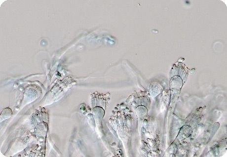 אחד הפטריות של הסוג אספרגילוס 